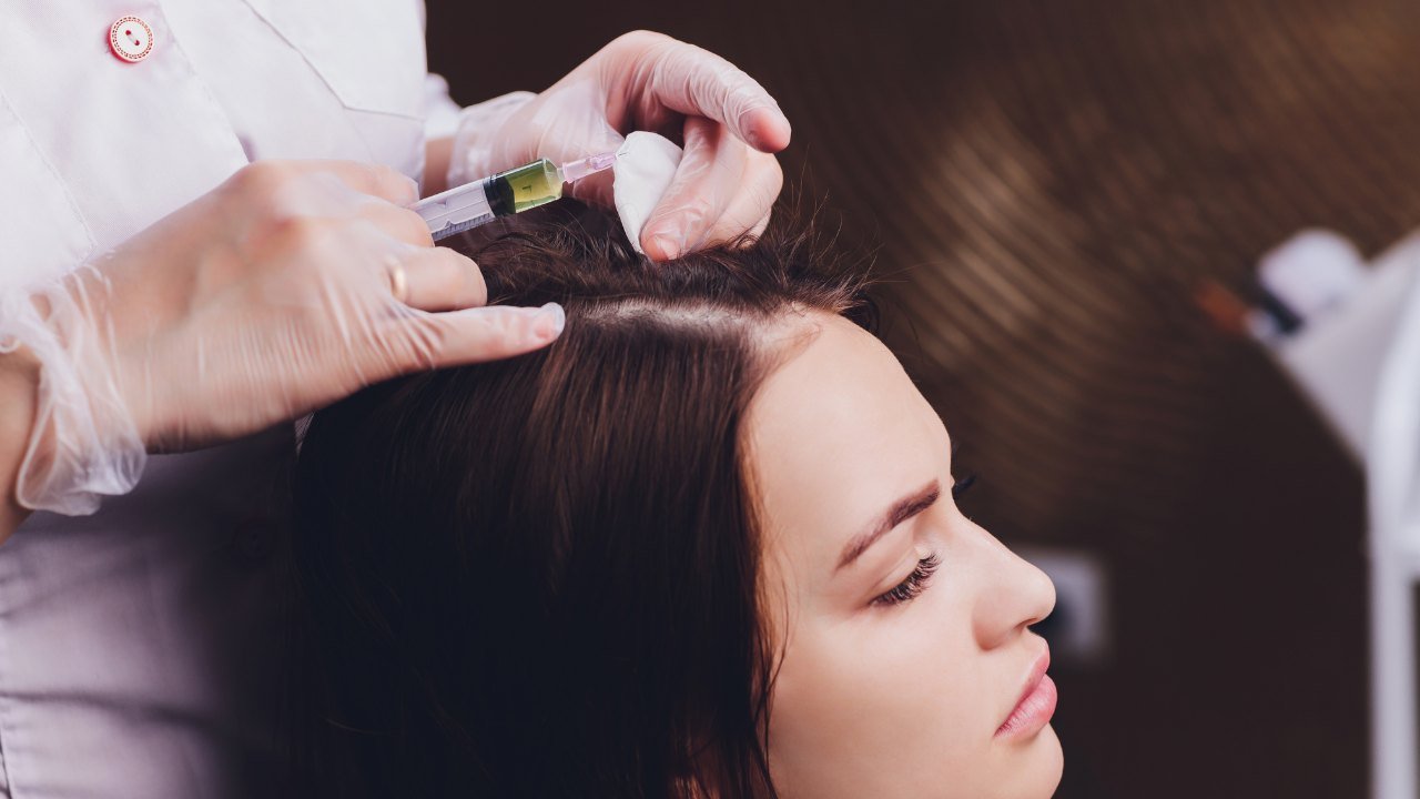 PRP vs Hair Transplant: Which Is Better for You?